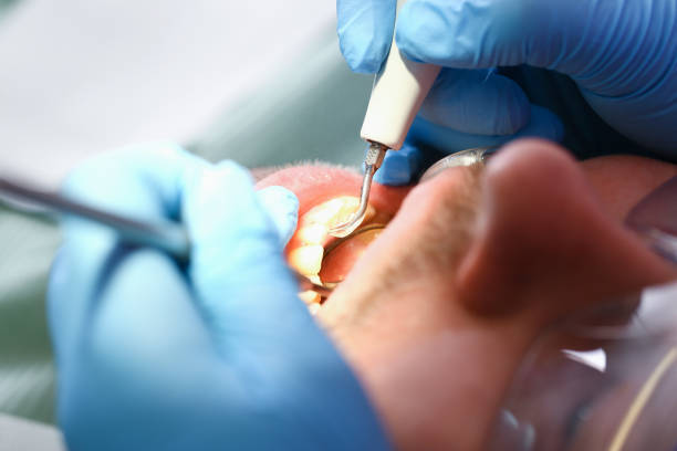 Best Broken or Cracked Tooth Emergency Dentist in Good Hope, CA